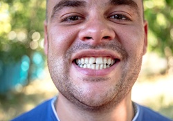 A man standing outside in a blue shirt smiling to show his chipped front tooth