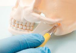 Dentist pointing to TMJ joint on model of a skull