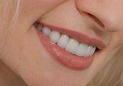 Closeup of flawless smile