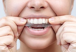Person applying whitening strip to her teeth