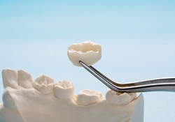 A closeup of a dental crown held by a pair of tweezers