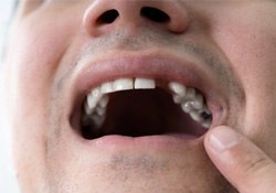 A close-up of a young man with missing teeth