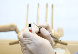A dentist using a specialized tool to extract composite resin in preparation for placing it on a patient’s tooth