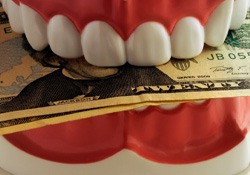 a model of a mouth biting down on money 