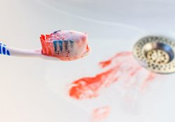 A bloodied toothbrush