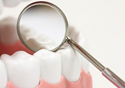 Closeup of teeth with dental sealants