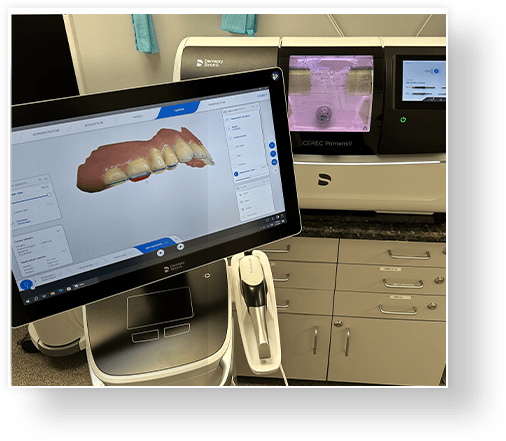 C E R E C digital smile design