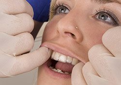 Harrisonburg Invisalign Woman getting teeth examined