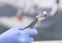 A dentist holding an extracted tooth.