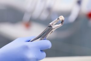 tooth in forceps