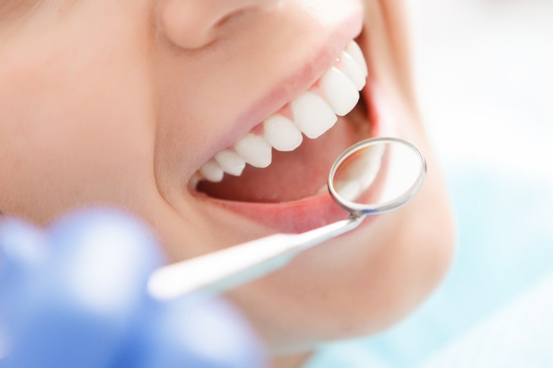 An up-close image of a person’s smile while a dentist uses a dental mirror to examine their oral cavity