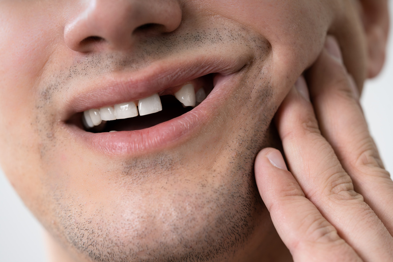 Man with a knocked-out tooth