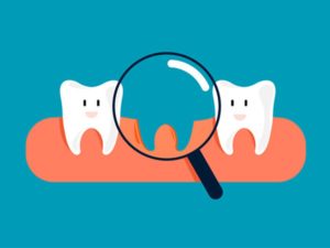 a cartoon image of a missing tooth