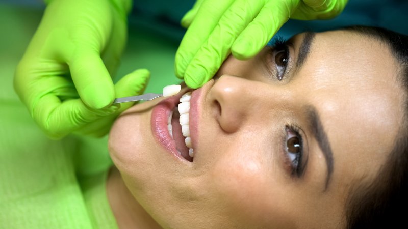 Dentist color matching a woman’s tooth