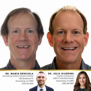 Before and after image of Charlie’s case